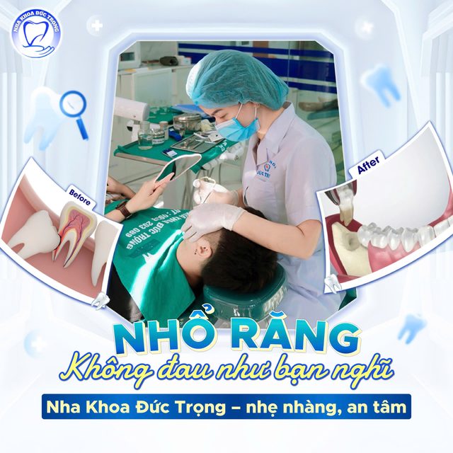 Bài đăng về nhổ răng nhẹ nhàng tại phòng khám
