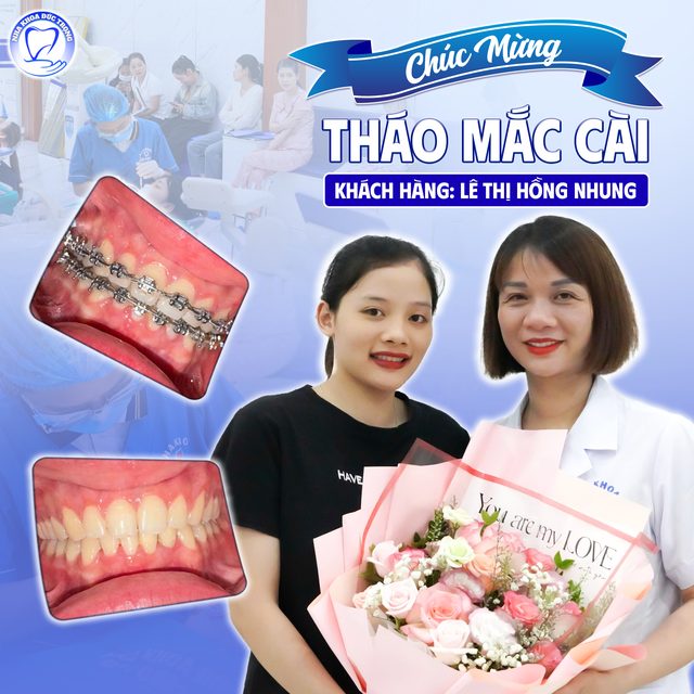 Bài đăng chúc mừng chị Lê Thị Hồng Nhung tháo mắc cài, kèm ảnh răng trước và sau