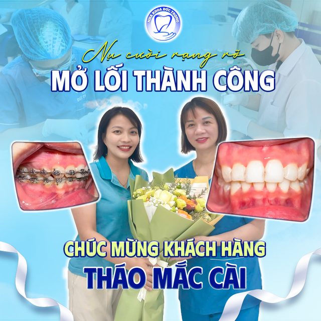 Bài đăng chúc mừng khách hàng tháo mắc cài