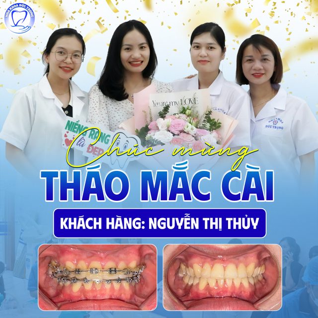 Bài đăng chúc mừng chị Nguyễn Thị Thủy tháo mắc cài, kèm ảnh răng trước và sau