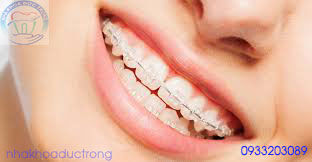 chỉnh nha - niềng răng thế hệ mới tại núi đèo thủy nguyên hải phòng