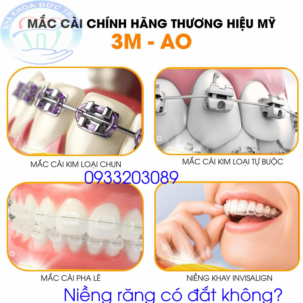 Niềng răng có đắt không? Niềng răng - Chỉnh nha ở Núi Đèo Thủy Nguyên