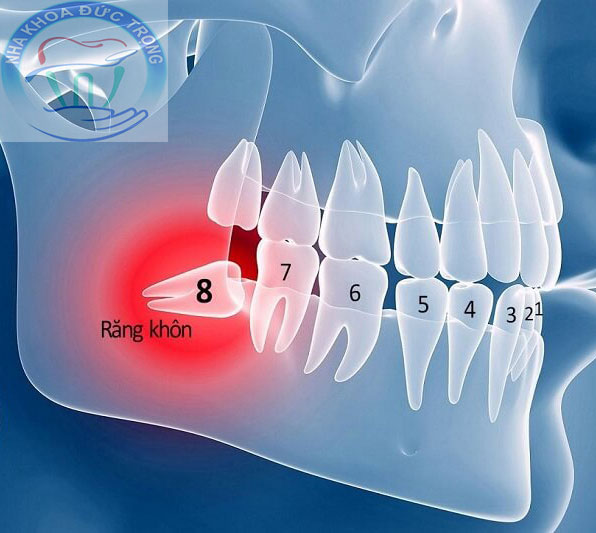 Dịch vụ nhổ răng không đau tại nha khoa núi đèo thủy nguyên?