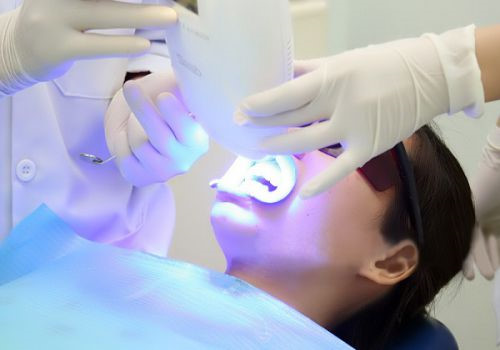 Tẩy trắng răng uy tín tại Thủy Nguyên