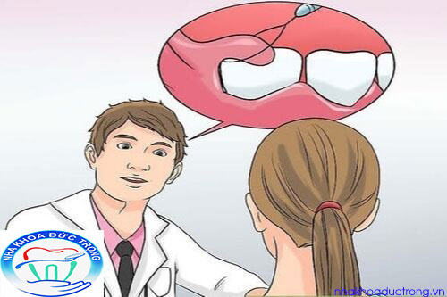 Cắt lợi trùm - có đâu không? Bao nhiêu lâu thì khỏi?